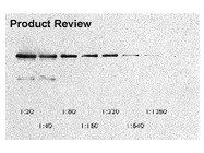 ECL™ Western Blotting Detection Reagents From GE Healthcare