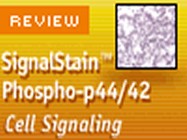 The SignalStain™ Phospho-p44/42 (Thr202/Tyr204) IHC Detection Kit from Cell Signaling Technology