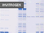 Novex® NuPAGE® Pre-cast Protein Gels by Invitrogen