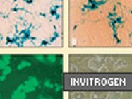 Lipofectamine™ 2000 Transfection Reagent From Invitrogen