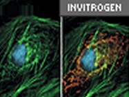 Prolong Gold Antifade Reagent From Molecular Probes (Invitrogen)