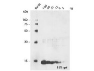 Penta-His Antibody from Qiagen, used in Western Blotting