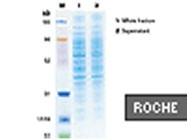 Complete Lysis-M EDTA-Free Lysis Buffer From Roche Applied Science