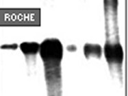 High Pure RNA Isolation Kit From Roche Applied Science