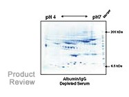 ProteoPrep® Blue Albumin and IgG Depletion Kit From Sigma-Aldrich