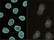 shRNA Lentiviral Particles from Santa Cruz Biotechnology
