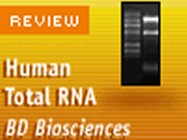 Premium RNA (Clontech, a Takara Bio Company)