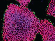  Choosing the Right Stem Cell Media