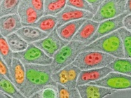  Confocal Microscopes: Know What You Need