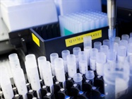  Lab Automation: Can It Help You?