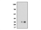 USP18 Rabbit Monoclonal Antibody from Cell Signaling Technology