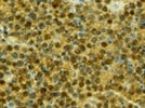 PTEN XP Rabbit Monoclonal Antibody (D4.3) from Cell Signaling Technology