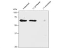 Alpha-2 Antiplasmin antibody (SJ-19) from Santa Cruz Biotechnology