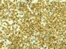 Bim Rabbit Monoclonal Antibody Clone Y36 from Abcam