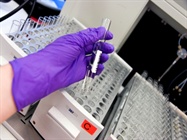  Protein Purification Tools