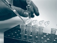  RNA Prep from Problem Samples