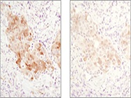 Optimizing IHC Staining
