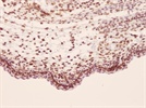 IHC Detection of Lamin B1