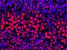 Ctip2 Staining