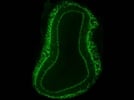 Detecting Adult neurogenesis in Rat Olfactory Bulb
