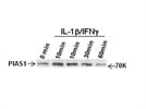 PIAS1 Antibody for Western Blot