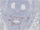 P63 Antibody: Very Nice Results
