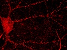 Calpain Antibody for ICC in Hippocampal Neurons