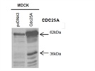 Cell Cycle and CDC25A