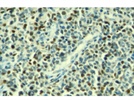 Anti c-Myc Monoclonal Antibody (Y69)
