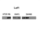 EMT Analysis: Lef1 Detection by WB