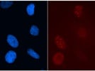Strong Signal: Anti-BRCA1 Immunofluorescence
