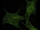Mfn-1 in Immuno-histochemistry