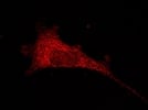 Staining for Mfn 2 in neural stem cells