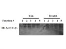 Acetylated-Lysine Antibody