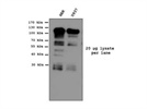 Specific Antibody Against Human Alanyl tRNA Synthetase