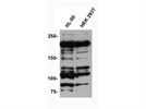 An Antibody that Serves the Purpose, Wonderfully