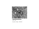 Exosome Isolation Reagent from Life Technologies