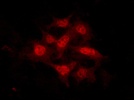 Excellent antibody for immunofluoresence detection of YAP/TAZ in mouse cells