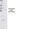 Phospho Akt protein expression analysis via Western blotting