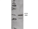 SC35 protein expression analysis via Western blotting