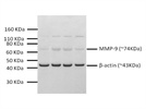 MMP9 in a mouse brain tumor model