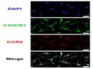 Best CX3CR1 antibody for immunostaining of cultured cells