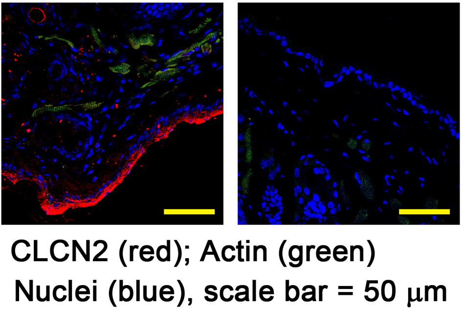 Chloride Channel Protein 2 (CLCN2) for confocal microscopy from Alomone ...