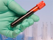  Detecting Circulating Tumor Cells