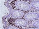 Galectin-1 IHC detection
