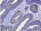 Galectin-4 Immunohistochemistry Detection