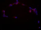 Cell Signaling's VEGFR2 Antibody for Immunofluorescence