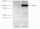 Good phospho STAT6 Antibody