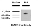 DYNC1I2 Detection in Western Blot