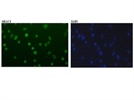 HDAC1 expression in N2A cells